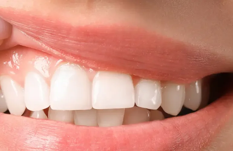 Tandvleesbehandeling