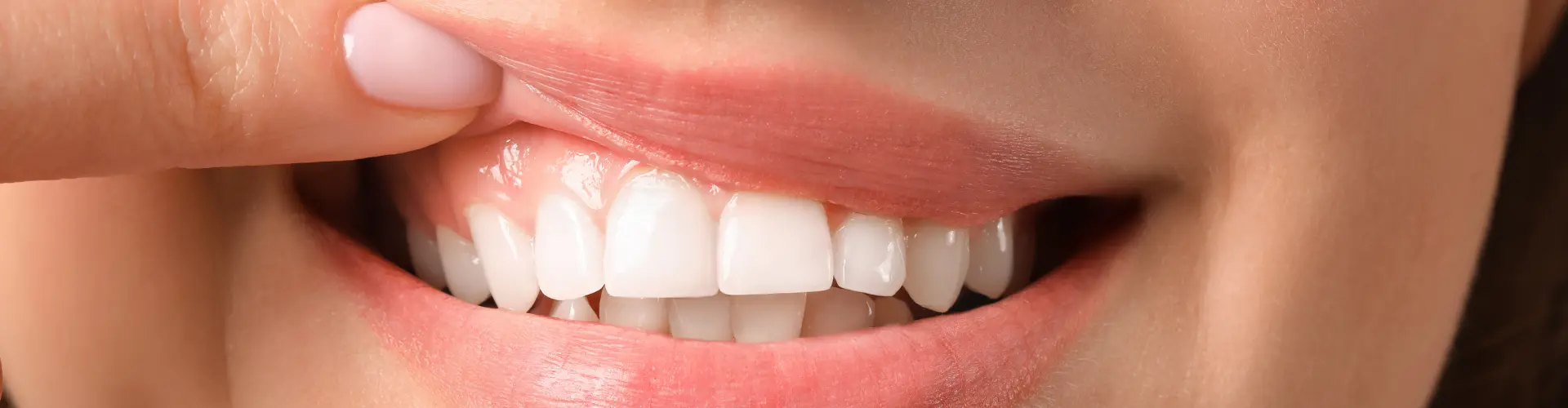 Tandvleesbehandeling