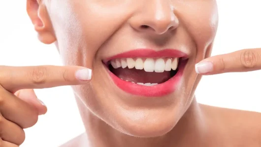 Mondverzorgingsadvies Poetsinstructies